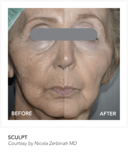Sculpt Before and After